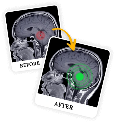 billionaire-brain-wave-programs-before-after